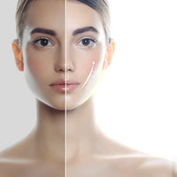 Levantamento facial led fóton terapia